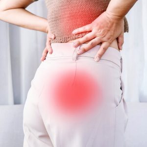 Sciatica Manchester IA