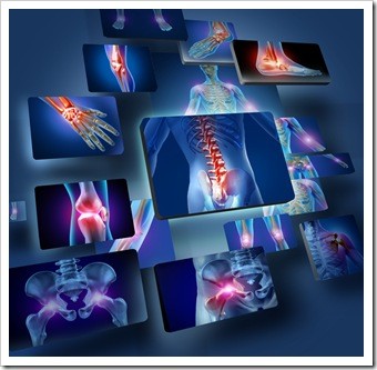 Joint Pain Manchester IA Back Pain