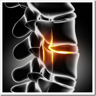 Slipped Disc Manchester IA